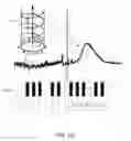 Fig. 07 - Methods and systems for treating tinnitus