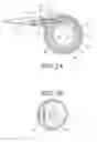 Fig. 03 - Implantable restriction system with release mechanism