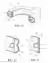 Fig. 06 - Implantable restriction system with release mechanism