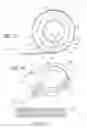 Fig. 12 - Implantable restriction system with release mechanism