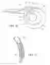 Fig. 13 - Implantable restriction system with release mechanism