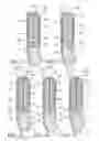 Fig. 19 - Implantable restriction system with release mechanism
