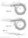 Fig. 31 - Implantable restriction system with release mechanism