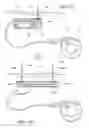 Fig. 33 - Implantable restriction system with release mechanism
