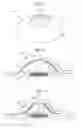 Fig. 04 - Space ensuring device