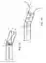 Fig. 07 - Penile prosthesis insertion tool and system