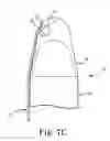 Fig. 08 - Penile prosthesis insertion tool and system