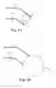 Fig. 05 - Penile prosthesis, penile prosthesis insertion tool and system thereof