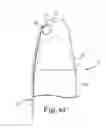 Fig. 06 - Penile prosthesis, penile prosthesis insertion tool and system thereof