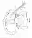 Fig. 09 - Penile prosthesis, penile prosthesis insertion tool and system thereof