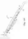 Fig. 12 - Penile prosthesis cap and assembly