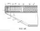 Fig. 09 - Endoscope system for treatment of sinusitis
