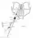 Fig. 14 - Endoscope system for treatment of sinusitis