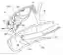 Fig. 01 - Applicator for endoscopic treatment of biliary disease