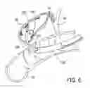 Fig. 08 - Applicator for endoscopic treatment of biliary disease