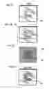 Fig. 07 - Method of controlling endoscope and endoscope