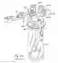Fig. 16 - Instrument Access Device