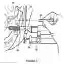 Fig. 04 - Manual Instrumented Medical Tool System