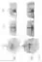 Fig. 06 - Magnetic resonance imaging apparatus reconstructing rephase and dephase images