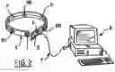 Fig. 03 - METHOD AND SYSTEM FOR LOCALIZING AN INGESTIBLE ELEMENT FOR THE FUNCTIONAL INVESTIGATION OF THE DIGESTIVE TRACT