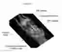 Fig. 48 - Animal holder for in vivo tomographic imaging with multiple modalities