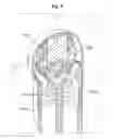 Fig. 06 - THREE-DIMENSIONAL PROBE APPARATUS