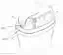 Fig. 01 - ULTRASONIC PROBE