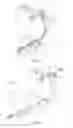 Fig. 10 - ULTRASONIC PROBE