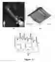 Fig. 06 - FUNCTIONAL NEAR-INFRARED FLUORESCENCE LYMPHATIC MAPPING FOR DIAGNOSING, ACCESSING, MONITORING AND DIRECTING THERAPY OF LYMPHATIC DISORDERS