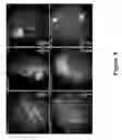 Fig. 09 - FUNCTIONAL NEAR-INFRARED FLUORESCENCE LYMPHATIC MAPPING FOR DIAGNOSING, ACCESSING, MONITORING AND DIRECTING THERAPY OF LYMPHATIC DISORDERS