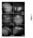 Fig. 10 - FUNCTIONAL NEAR-INFRARED FLUORESCENCE LYMPHATIC MAPPING FOR DIAGNOSING, ACCESSING, MONITORING AND DIRECTING THERAPY OF LYMPHATIC DISORDERS