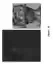Fig. 16 - FUNCTIONAL NEAR-INFRARED FLUORESCENCE LYMPHATIC MAPPING FOR DIAGNOSING, ACCESSING, MONITORING AND DIRECTING THERAPY OF LYMPHATIC DISORDERS
