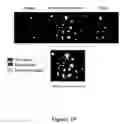 Fig. 20 - FUNCTIONAL NEAR-INFRARED FLUORESCENCE LYMPHATIC MAPPING FOR DIAGNOSING, ACCESSING, MONITORING AND DIRECTING THERAPY OF LYMPHATIC DISORDERS