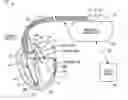 Fig. 01 - Method and apparatus for sensing mechanical energy of an implantable lead