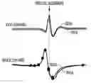 Fig. 01 - MORPHOLOGY BASED ISCHEMIA DETECTION USING INTRACARDIAC ELECTROGRAMS