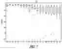 Fig. 06 - MORPHOLOGY BASED ISCHEMIA DETECTION USING INTRACARDIAC ELECTROGRAMS