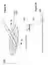 Fig. 04 - Pleural drainage system and method of use
