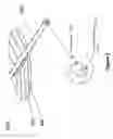 Fig. 06 - Pleural drainage system and method of use