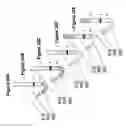 Fig. 21 - Pleural drainage system and method of use