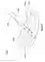 Fig. 22 - Pleural drainage system and method of use