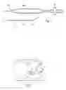 Fig. 02 - CRYOSURGICAL INSTRUMENT FOR OBTAINING A TISSUE SAMPLE, METHOD FOR CHILLING A PROBE HEAD OF A CRYOSURGICAL PROBE