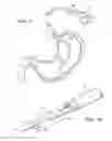 Fig. 07 - BIOPSY DEVICE
