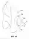 Fig. 09 - Biopsy marker delivery devices and methods