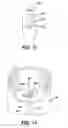 Fig. 11 - Biopsy marker delivery devices and methods