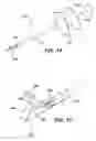 Fig. 13 - Biopsy marker delivery devices and methods