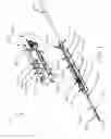 Fig. 02 - Biopsy device with translating valve member
