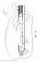 Fig. 19 - Biopsy device with translating valve member