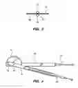 Fig. 03 - Apparatus for measuring anatomic angles