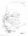 Fig. 02 - Discontinuous positive airway pressure device and method of reducing sleep disordered breathing events