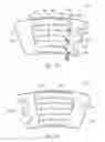 Fig. 02 - Compression sleeve